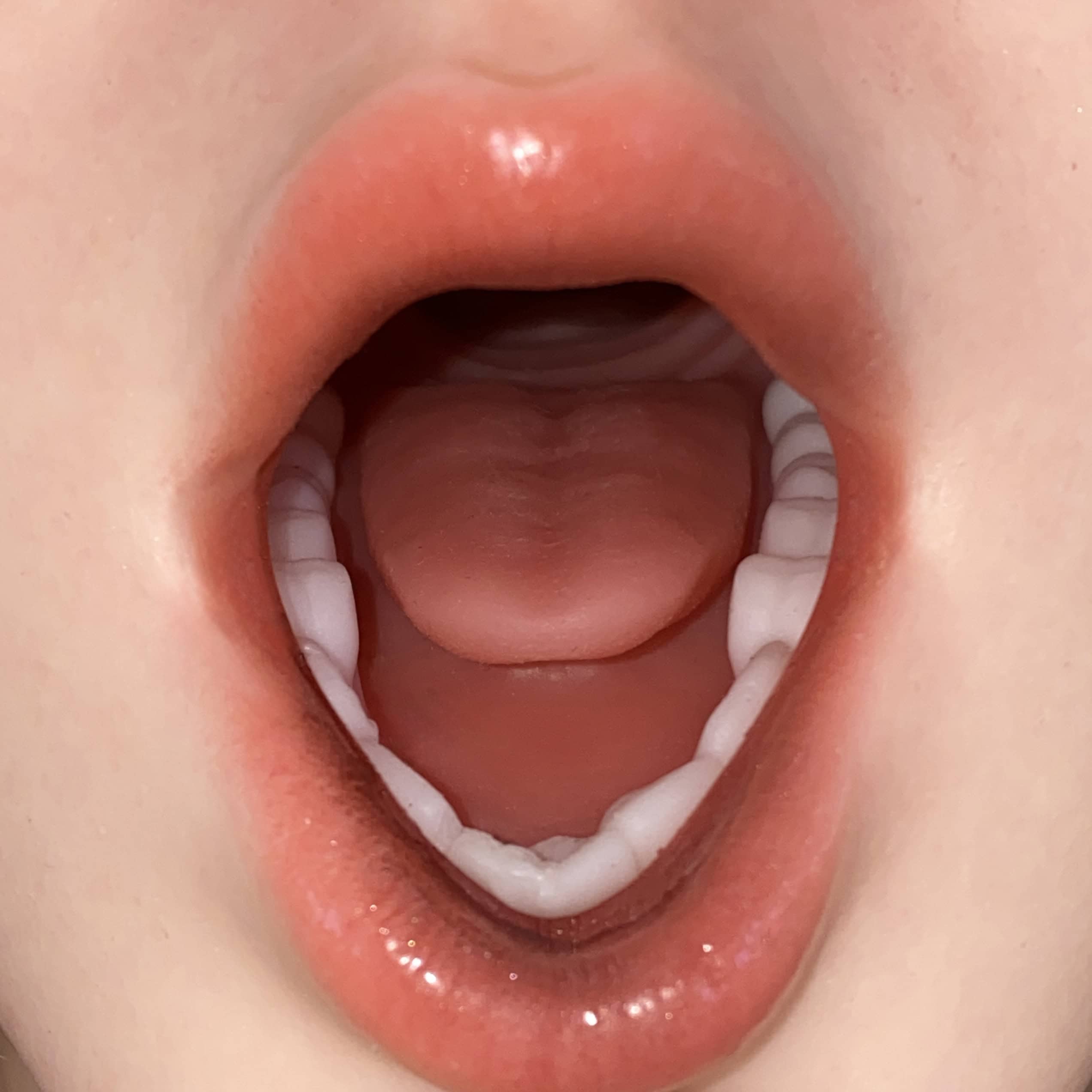 Open Mouth with Oral Structure Focus